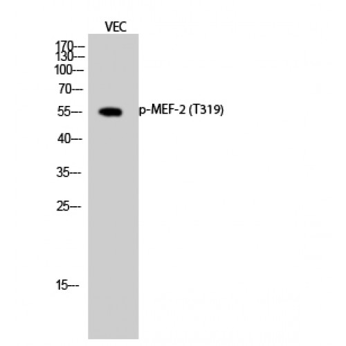 MEF2A / MEF2 Antibody - Western blot of Phospho-MEF-2 (T319) antibody
