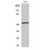 MEF2A / MEF2 Antibody - Western blot of Phospho-MEF-2 (S408) antibody