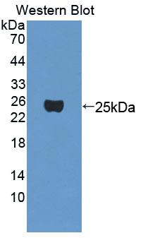 MEF2A / MEF2 Antibody - Western blot of MEF2A / MEF2 antibody.