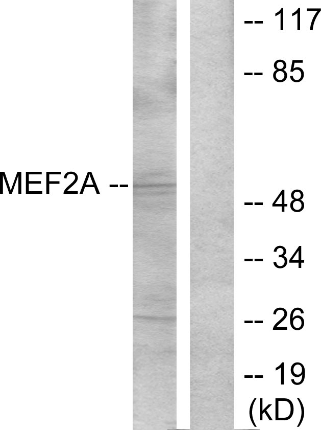 MEF2A / MEF2 Antibody - Western blot analysis of lysates from NIH/3T3 cells, treated with PMA, using MEF2A Antibody. The lane on the right is blocked with the synthesized peptide.