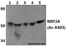 MEF2A / MEF2 Antibody - Western blot of MEF2A (Acetyl-K403) polyclonal antibody at 1:500 dilution. Lane 1: The muscle tissue lysate of Mouse(30 ug). Lane 2: The muscle tissue lysate of Rat(30 ug). Lane 3: The brain tissue lysate of Mouse(30 ug). Lane 4: The brain tissue lysate of.