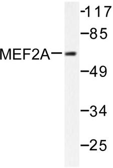 MEF2A / MEF2 Antibody - Western blot of MEF2A (A306) pAb in extracts from NIH/3T3 cells treated with PMA.
