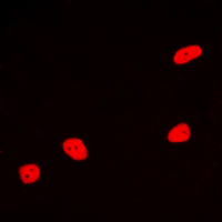 MEF2A / MEF2 Antibody - Immunofluorescent analysis of MEF2A staining in HeLa cells. Formalin-fixed cells were permeabilized with 0.1% Triton X-100 in TBS for 5-10 minutes and blocked with 3% BSA-PBS for 30 minutes at room temperature. Cells were probed with the primary antibody in 3% BSA-PBS and incubated overnight at 4 deg C in a humidified chamber. Cells were washed with PBST and incubated with a DyLight 594-conjugated secondary antibody (red) in PBS at room temperature in the dark. DAPI was used to stain the cell nuclei (blue).