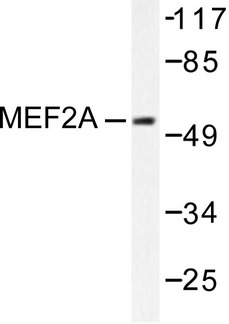 MEF2A / MEF2 Antibody - Western blot of MEF2A (I402) pAb in extracts from HeLa cells.