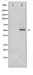 MEF2A / MEF2 Antibody - Western blot of MEF2A expression in PMA treated NIH-3T3 whole cell lysates,The lane on the left is treated with the antigen-specific peptide.