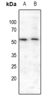MEF2A / MEF2 Antibody - Western blot analysis of MEF2A (pS408) expression in HEK293T (A), A549 (B) whole cell lysates.
