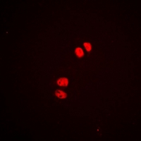 MEF2A / MEF2 Antibody - Immunofluorescent analysis of MEF2A (pS408) staining in HeLa cells. Formalin-fixed cells were permeabilized with 0.1% Triton X-100 in TBS for 5-10 minutes and blocked with 3% BSA-PBS for 30 minutes at room temperature. Cells were probed with the primary antibody in 3% BSA-PBS and incubated overnight at 4 °C in a hidified chamber. Cells were washed with PBST and incubated with Alexa Fluor 647-conjugated secondary antibody (red) in PBS at room temperature in the dark.