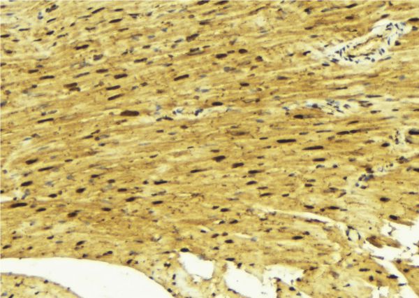 MEF2A / MEF2 Antibody - 1:100 staining mouse muscle tissue by IHC-P. The sample was formaldehyde fixed and a heat mediated antigen retrieval step in citrate buffer was performed. The sample was then blocked and incubated with the antibody for 1.5 hours at 22°C. An HRP conjugated goat anti-rabbit antibody was used as the secondary.