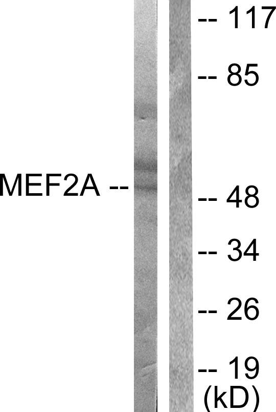 MEF2A / MEF2 Antibody - Western blot analysis of extracts from Hela cells treated with PMA (125ng/ml, 30min), using MEF2A (Ab-408) antibody ( Line 1 and 2).
