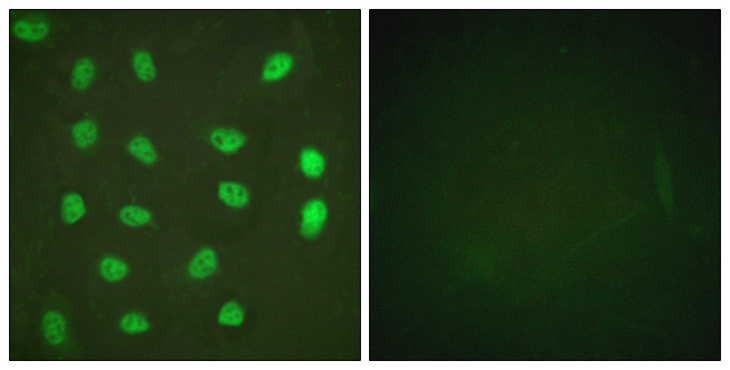 MEF2A / MEF2 Antibody - Immunofluorescence analysis of HeLa cells treated with PMA 125ng/ml 30', using MEF2A (Phospho-Ser408) Antibody. The picture on the right is blocked with the phospho peptide.