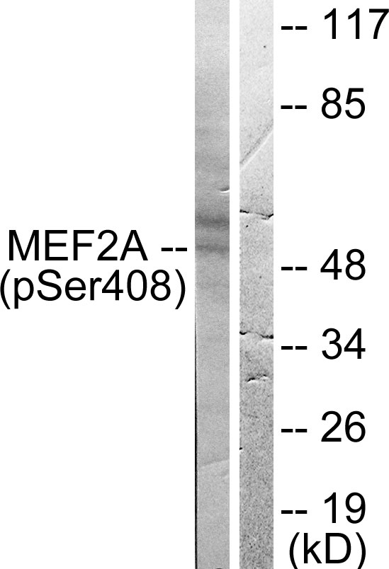 MEF2A / MEF2 Antibody - Western blot analysis of lysates from HeLa cells treated with PMA 125ng/ml 30', using MEF2A (Phospho-Ser408) Antibody. The lane on the right is blocked with the phospho peptide.