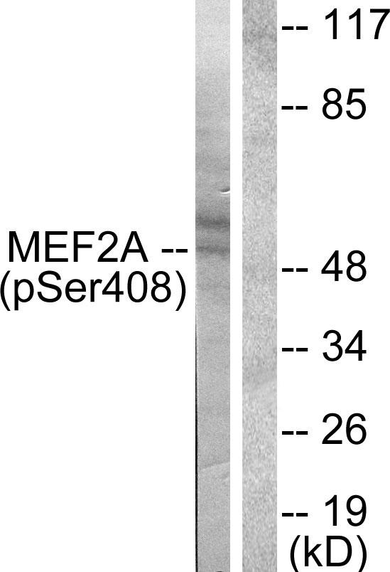MEF2A / MEF2 Antibody - Western blot analysis of extracts from Hela cells treated with PMA (125ng/ml, 30mins), using MEF2A (phospho-Ser408) antibody.