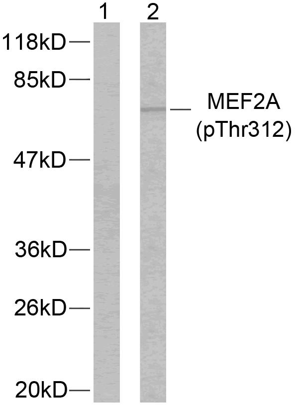 MEF2A / MEF2 Antibody - Western blot analysis of lysates from NIH/3T3 cells treated with PMA, using MEF2A (Phospho-Thr312) Antibody. The lane on the left is blocked with the phospho peptide.