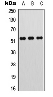 MEF2A / MEF2 Antibody - Western blot analysis of MEF2A (pT312) expression in HeLa (A); mouse liver (B); NIH3T3 (C) whole cell lysates.