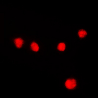 MEF2A / MEF2 Antibody - Immunofluorescent analysis of MEF2A (pT312) staining in HeLa cells. Formalin-fixed cells were permeabilized with 0.1% Triton X-100 in TBS for 5-10 minutes and blocked with 3% BSA-PBS for 30 minutes at room temperature. Cells were probed with the primary antibody in 3% BSA-PBS and incubated overnight at 4 deg C in a humidified chamber. Cells were washed with PBST and incubated with a DyLight 594-conjugated secondary antibody (red) in PBS at room temperature in the dark. DAPI was used to stain the cell nuclei (blue).