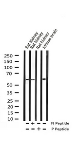 MEF2A / MEF2 Antibody - Western blot analysis of Phospho-MEF2A (Thr312) expression in various lysates