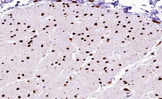 MEF2A / MEF2 Antibody - 1:200 staining human Smooth muscle tissue by IHC-P. The tissue was formaldehyde fixed and a heat mediated antigen retrieval step in citrate buffer was performed. The tissue was then blocked and incubated with the antibody for 1.5 hours at 22°C. An HRP conjugated goat anti-rabbit antibody was used as the secondary.