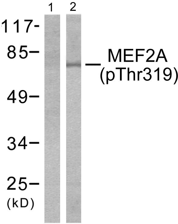 MEF2A / MEF2 Antibody - Western blot analysis of lysates from K562 cells treated with UV 15', using MEF2A (Phospho-Thr319) Antibody. The lane on the left is blocked with the phospho peptide.