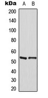 MEF2A / MEF2 Antibody - Western blot analysis of MEF2A (pT319) expression in HeLa (A); mouse liver (B) whole cell lysates.