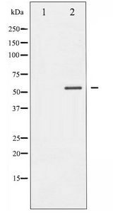 MEF2A / MEF2 Antibody - Western blot of MEF2A phosphorylation expression in UV treated K562 whole cell lysates,The lane on the left is treated with the antigen-specific peptide.