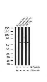 MEF2A / MEF2 Antibody - Western blot analysis of Phospho-MEF2A (Thr319) expression in various lysates