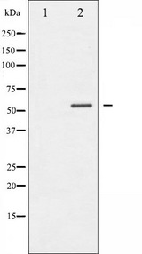 MEF2A / MEF2 Antibody - Western blot analysis of MEF2A phosphorylation expression in UV treated K562 whole cells lysates. The lane on the left is treated with the antigen-specific peptide.
