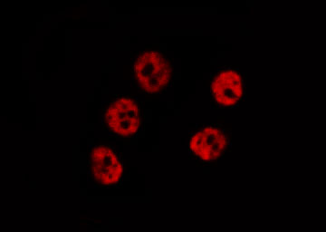MEF2A / MEF2 Antibody - Staining HeLa cells by IF/ICC. The samples were fixed with PFA and permeabilized in 0.1% Triton X-100, then blocked in 10% serum for 45 min at 25°C. The primary antibody was diluted at 1:200 and incubated with the sample for 1 hour at 37°C. An Alexa Fluor 594 conjugated goat anti-rabbit IgG (H+L) Ab, diluted at 1/600, was used as the secondary antibody.