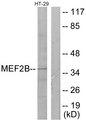 MEF2B Antibody - Western blot analysis of extracts from HT-29 cells, using MEF2B antibody.