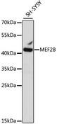 MEF2B Antibody - Western blot analysis of extracts of SH-SY5Y cells using MEF2B Polyclonal Antibody at dilution of 1:1000.
