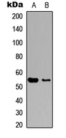 MEF2C Antibody - Western blot analysis of MEF2C expression in HeLa (A); NIH3T3 (B) whole cell lysates.
