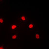 MEF2C Antibody - Immunofluorescent analysis of MEF2C staining in PC12 cells. Formalin-fixed cells were permeabilized with 0.1% Triton X-100 in TBS for 5-10 minutes and blocked with 3% BSA-PBS for 30 minutes at room temperature. Cells were probed with the primary antibody in 3% BSA-PBS and incubated overnight at 4 deg C in a humidified chamber. Cells were washed with PBST and incubated with a DyLight 594-conjugated secondary antibody (red) in PBS at room temperature in the dark. DAPI was used to stain the cell nuclei (blue).
