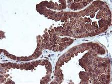 MEF2C Antibody - IHC of paraffin-embedded Human breast tissue using anti-MEF2C mouse monoclonal antibody.