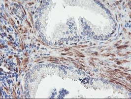 MEF2C Antibody - IHC of paraffin-embedded Human prostate tissue using anti-MEF2C mouse monoclonal antibody.