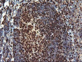 MEF2C Antibody - IHC of paraffin-embedded Human tonsil using anti-MEF2C mouse monoclonal antibody.