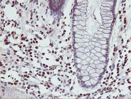 MEF2C Antibody - IHC of paraffin-embedded Human colon tissue using anti-MEF2C mouse monoclonal antibody.