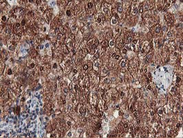 MEF2C Antibody - IHC of paraffin-embedded Human liver tissue using anti-MEF2C mouse monoclonal antibody.