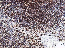 MEF2C Antibody - IHC of paraffin-embedded Human tonsil using anti-MEF2C mouse monoclonal antibody.