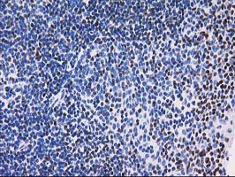 MEF2C Antibody - IHC of paraffin-embedded Human lymph node tissue using anti-MEF2C mouse monoclonal antibody. (Heat-induced epitope retrieval by 10mM citric buffer, pH6.0, 100C for 10min).