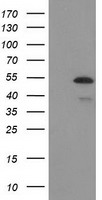 MEF2C Antibody - HEK293T cells were transfected with the pCMV6-ENTRY control (Left lane) or pCMV6-ENTRY MEF2C (Right lane) cDNA for 48 hrs and lysed. Equivalent amounts of cell lysates (5 ug per lane) were separated by SDS-PAGE and immunoblotted with anti-MEF2C.