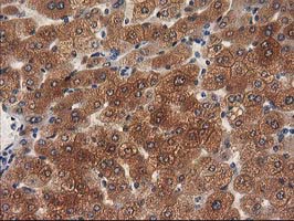 MEF2C Antibody - IHC of paraffin-embedded Human liver tissue using anti-MEF2C mouse monoclonal antibody.