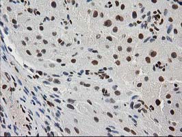 MEF2C Antibody - IHC of paraffin-embedded Human Ovary tissue using anti-MEF2C mouse monoclonal antibody.