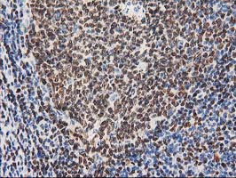 MEF2C Antibody - IHC of paraffin-embedded Human lymph node tissue using anti-MEF2C mouse monoclonal antibody.