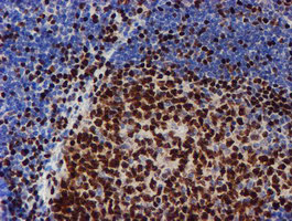 MEF2C Antibody - IHC of paraffin-embedded Human tonsil using anti-MEF2C mouse monoclonal antibody. (Heat-induced epitope retrieval by 10mM citric buffer, pH6.0, 100C for 10min).