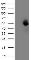 MEF2C Antibody - HEK293T cells were transfected with the pCMV6-ENTRY control (Left lane) or pCMV6-ENTRY MEF2C (Right lane) cDNA for 48 hrs and lysed. Equivalent amounts of cell lysates (5 ug per lane) were separated by SDS-PAGE and immunoblotted with anti-MEF2C.