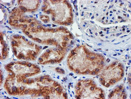 MEF2C Antibody - IHC of paraffin-embedded Human Kidney tissue using anti-MEF2C mouse monoclonal antibody. (Heat-induced epitope retrieval by 10mM citric buffer, pH6.0, 100C for 10min).