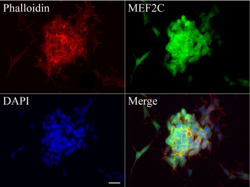 MEF2C Antibody - Immunofluorescent staining of SH-SY5Y cells using anti-MEF2C mouse monoclonal antibody  green, 1:100). Actin filaments were labeled with Alexa Fluor® 594 Phalloidin. (red), and nuclear with DAPI. (blue). Scale bar, 20µm.