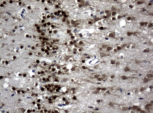 MEF2C Antibody - Immunohistochemical staining of paraffin-embedded Human embryonic brain tissue using anti-MEF2C mouse monoclonal antibody. (Clone UMAB17; heat-induced epitope retrieval by 10mM citric buffer, pH6.0, 120C for 3min)