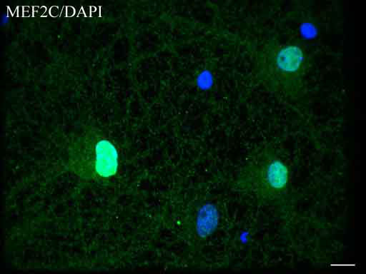 MEF2C Antibody - Confocal immunofluoresce image of primary rat neurons labeled with anti-MEF2C mouse monoclonal antibody  green, 1:50) and with DAPI. (blue) for nuclear. Scale bar, 10µm.
