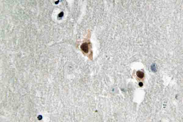 MEF2C Antibody - IHC of MEF-2C (I390) pAb in paraffin-embedded human brain tissue.