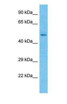 MEF2C Antibody - Western blot of MEF2C Antibody with human Fetal Kidney lysate.  This image was taken for the unconjugated form of this product. Other forms have not been tested.